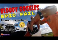 Bloody Goggles. I Crashed my drone into my head. Epic drone fail!