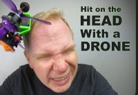 A Drone Crashed into my Head